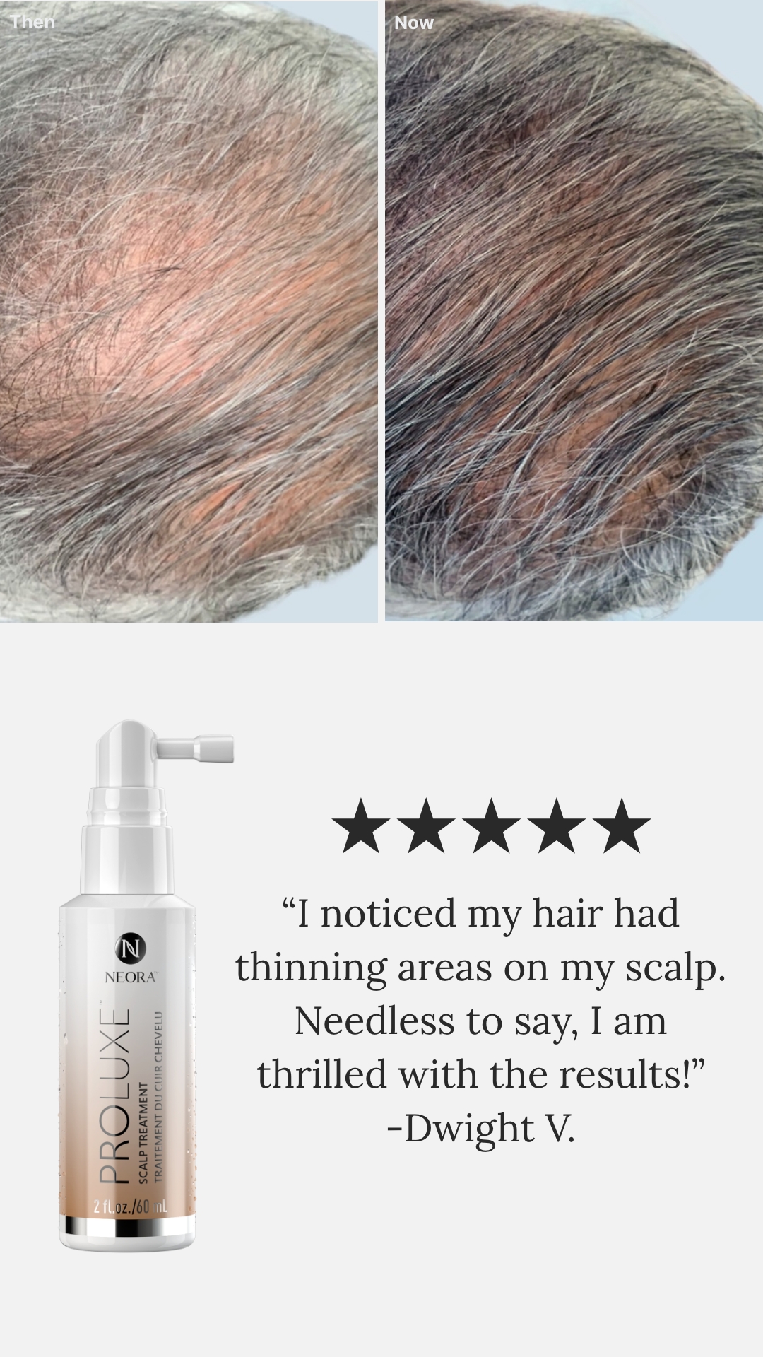 Neora testimonial
